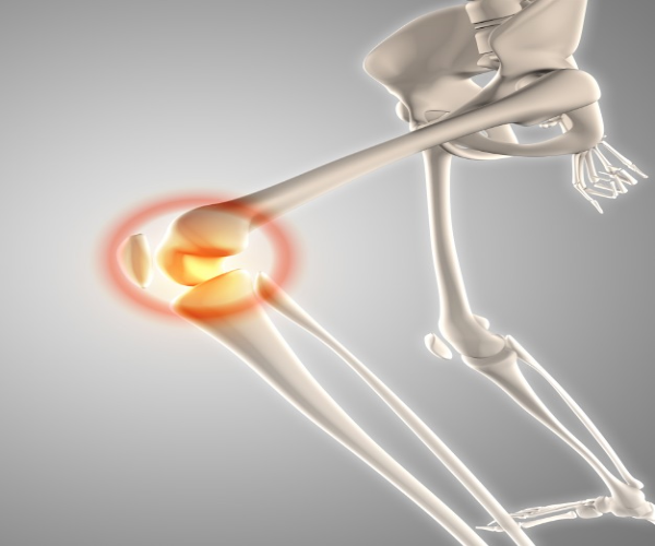 Best Osteoarthritis & Rheumatoid Arthritis Treatment Clinic in Central